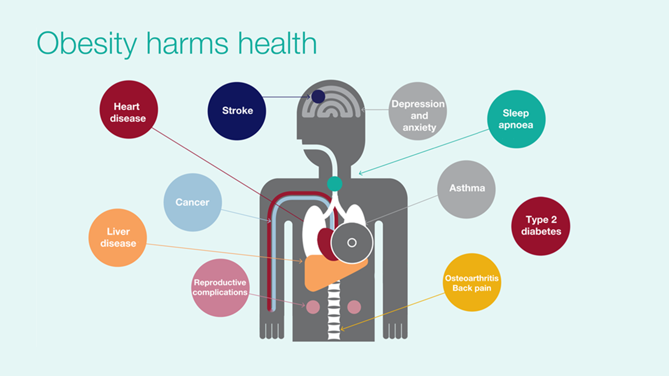 Obesity harms health