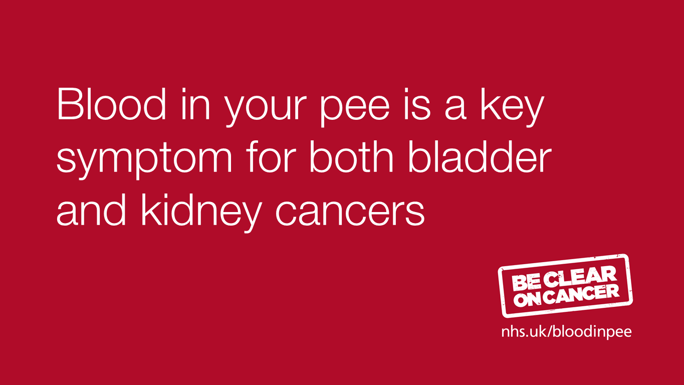 Bladder and kidney cancer – Be clear on the signs – UK Health