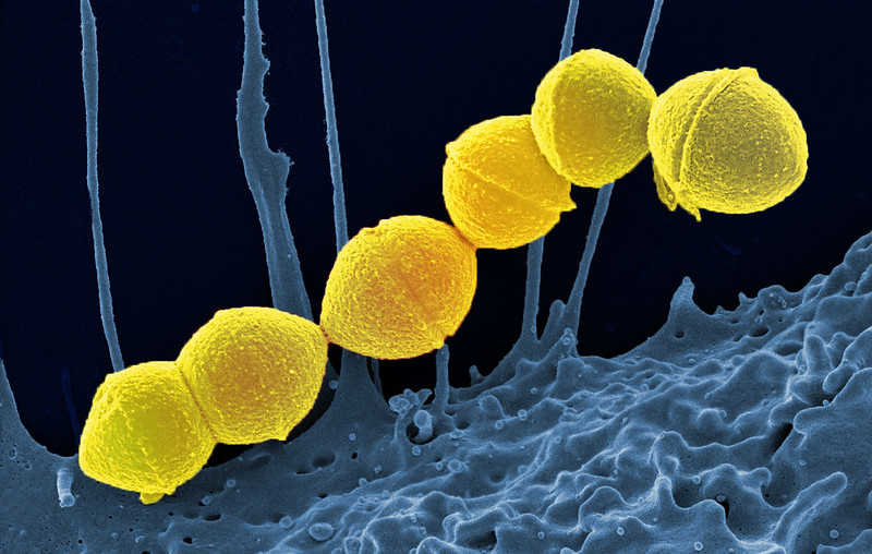  Group A streptococcus bacteria