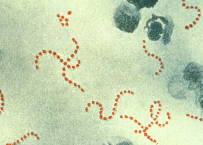Group A streptococcus bacteria 
