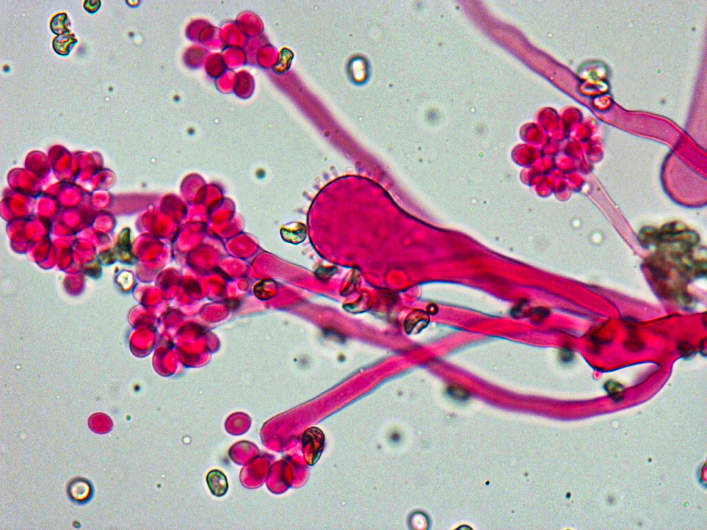 تصویری میکروسکوپی از قارچ Cunninghamella bertholletiae