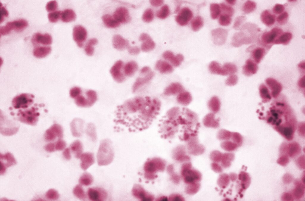 تصویر میکروسکوپی از باکتری نایسریا گونوره دیپلوکوک، منبع تصویربرداری شده از CDC.
