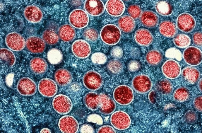 This is a colorized transmission electron microscopic image of mpox virus particles (red), found within an infected cell (blue), that had been cultured in the laboratory. The image was captured and colour-enhanced at the National Institute of Allergy and Infectious Diseases (NIAID), Integrated Research Facility (IRF), located in Fort Detrick, Maryland