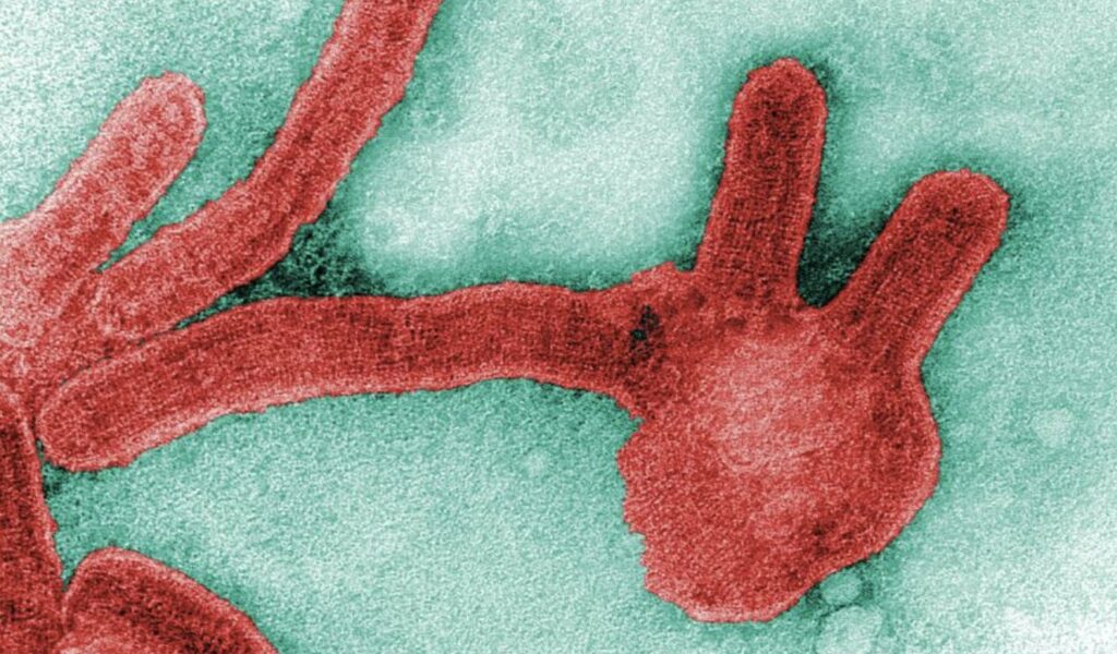 Marburg virus disease: what you need to know – UK Health Security Agency