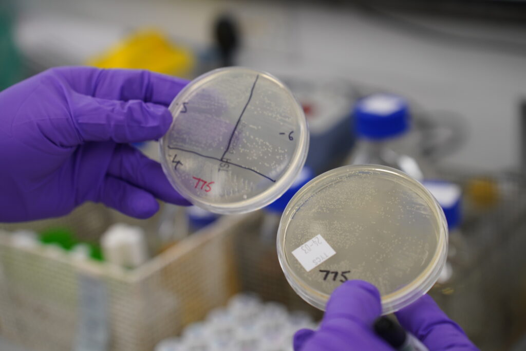 Bacterial samples in petri dishes