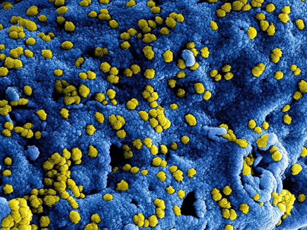 Middle East respiratory syndrome coronavirus (MERS-CoV) viral particles, located on the surface of a Vero E6 cell