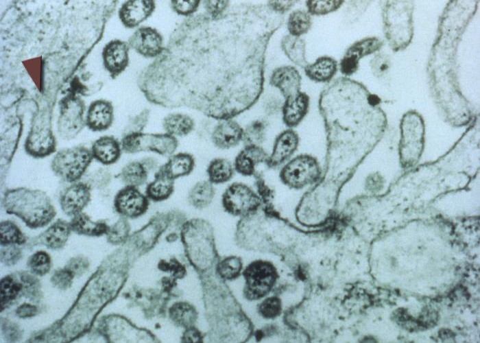 Lassa virus under a microscope. Image courtesy of Centers for Disease Control and Prevention